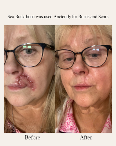 SEA BUCKTHORN SERUM (5ml)
